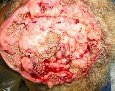 parazita u ljudskom mozgu